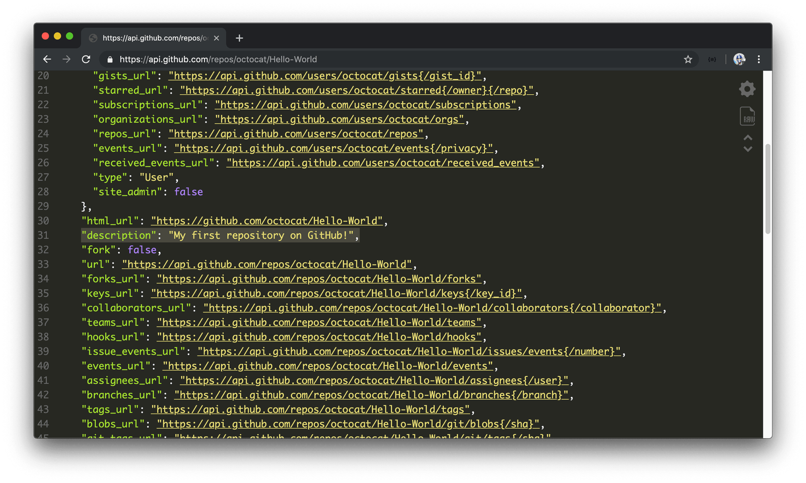 REST API get request returned data includes the description: My first repository on GitHub!
