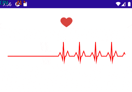 Heart ECG Monitor Demo Heart ECG Monitor Demo