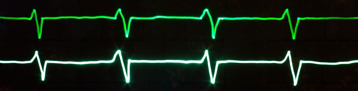 heartbeat_header